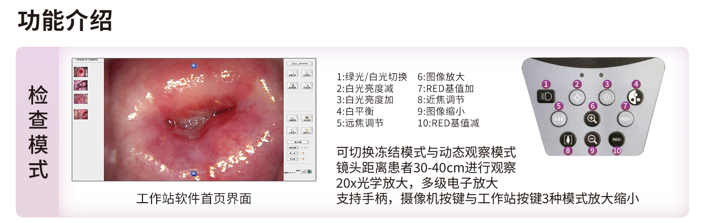 数码电子阴道镜