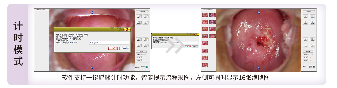 数码电子阴道镜