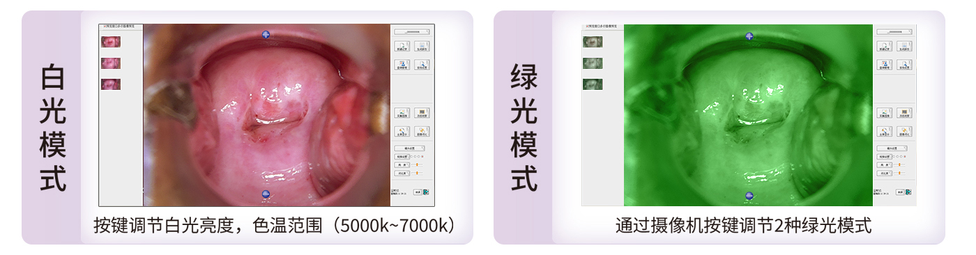 数码电子阴道镜