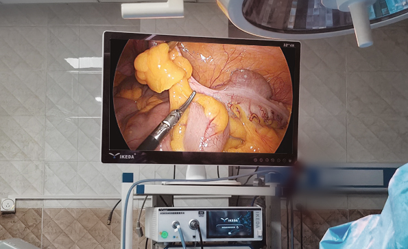 4K-3cmos-endoscope