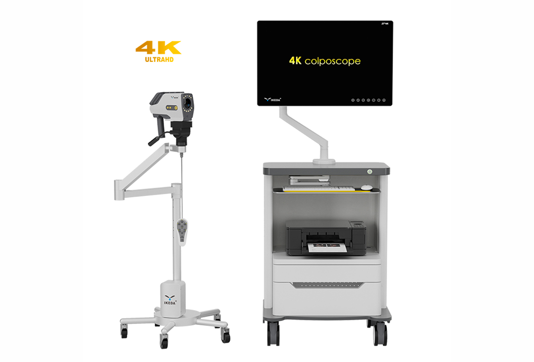 数码电子阴道镜