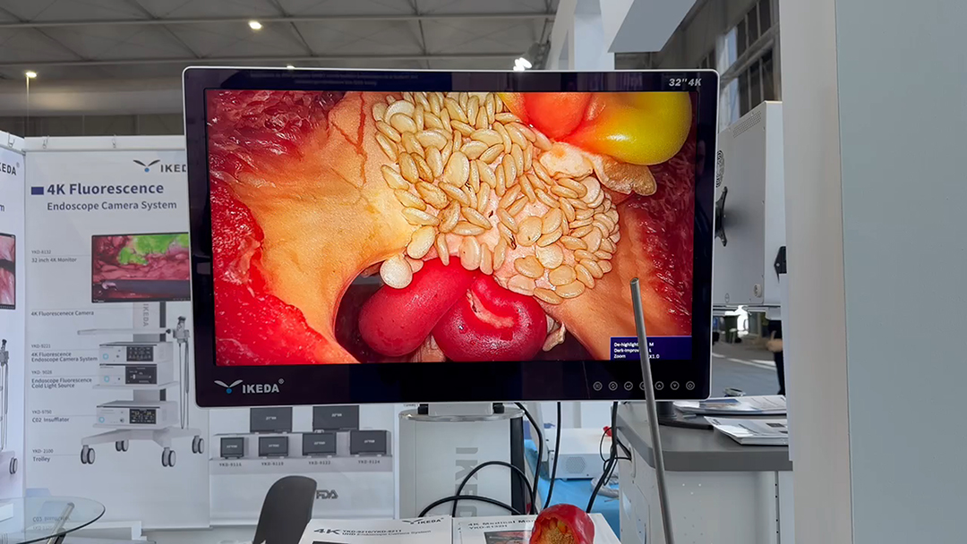 4K医用内窥镜摄像系统