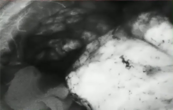 Black and White Fluorescence Mode