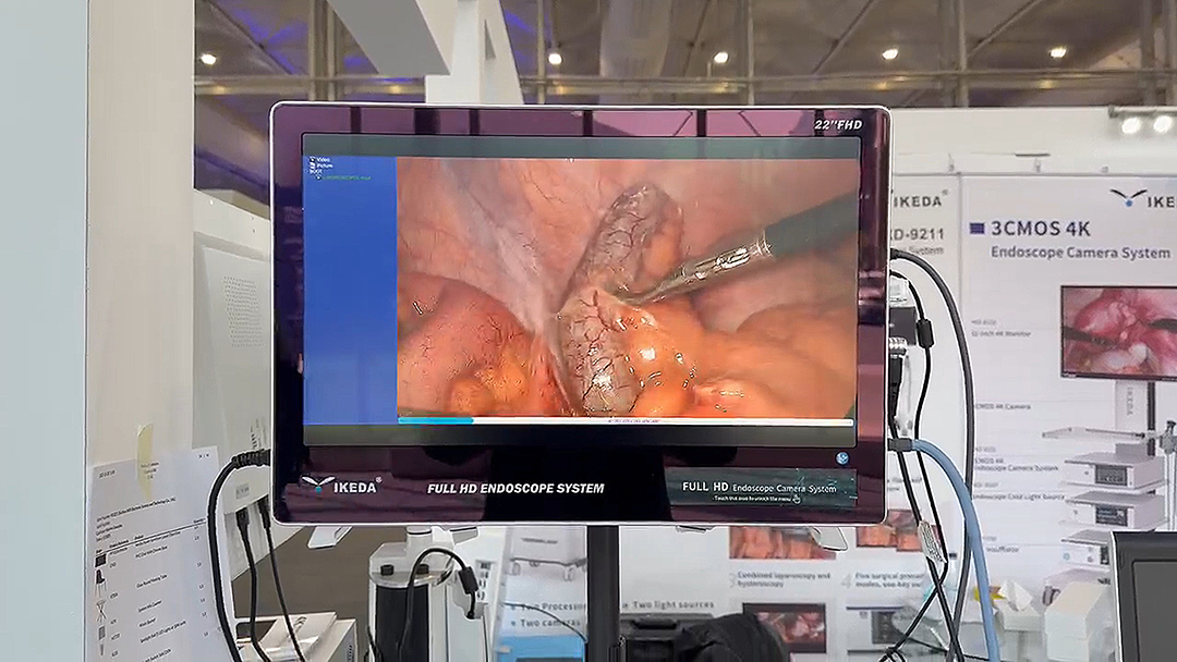 一体化内窥镜摄像系统