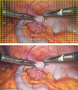4K Fluorescence Endoscope